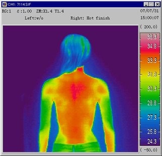 ビックリ感動サポーター【腰用】の温熱効果試験サーモグラフィ使用10分後