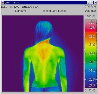 ビックリ感動サポーター【腰用】の温熱効果試験サーモグラフィ使用前